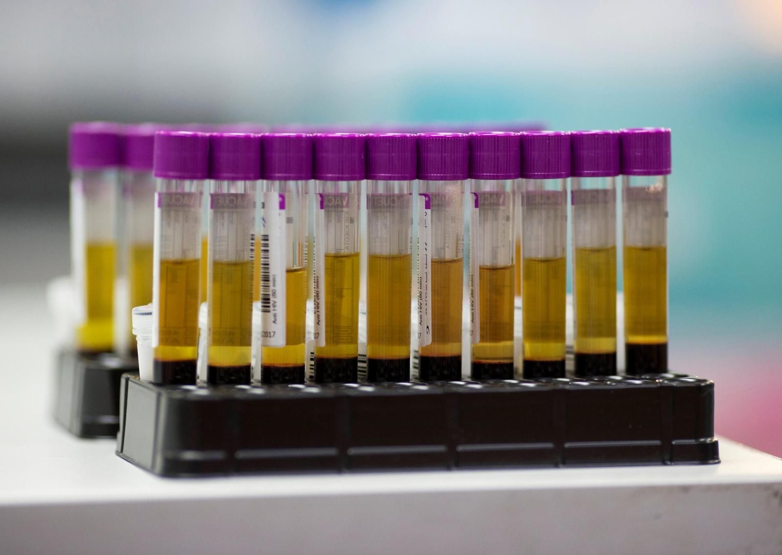 Examen de sangre experimental detecta cáncer de forma precoz - Ciencia ...