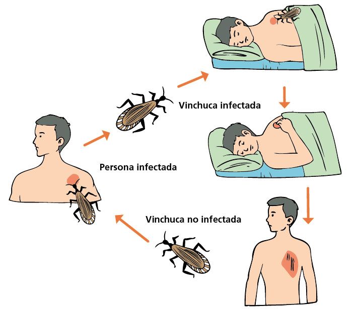 Mal de chagas Escolar ABC Color